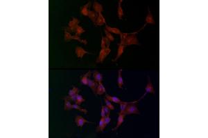 Immunofluorescence analysis of U-87 MG cells using  Rabbit pAb (ABIN3016805, ABIN3016806, ABIN3016807 and ABIN6219845) at dilution of 1:100. (ADAMTS5 抗体  (AA 731-930))