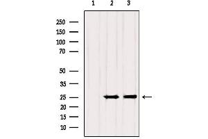 Western blot analysis of extracts from various samples, using RAB3A Antibody. (RAB3A 抗体  (N-Term))