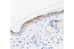 Immunohistochemistry of paraffin-embedded rat skin using Involucrin Rabbit mAb (ABIN6128025, ABIN6141815, ABIN6141818 and ABIN7101419) at dilution of 1:100 (40x lens). (Involucrin 抗体)
