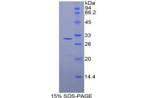 SDS-PAGE analysis of Rat Histone Deacetylase 6 Protein. (HDAC6 蛋白)
