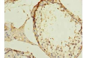 Immunohistochemistry of paraffin-embedded human testis tissue using ABIN7175982 at dilution of 1:100 (ZBTB43 抗体  (AA 165-467))
