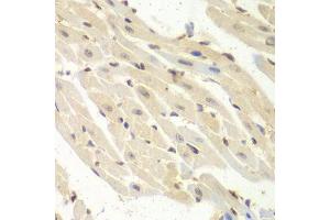 Immunohistochemistry of paraffin-embedded mouse heart using PSME1 antibody. (PSME1 抗体  (AA 1-249))