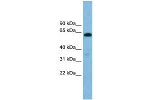 WB Suggested Anti-B4GALNT1 Antibody Titration: 0. (B4GALNT1 抗体  (Middle Region))