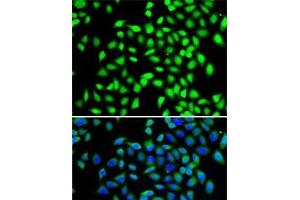 Immunofluorescence analysis of A-549 cells using SGTA Polyclonal Antibody (SGTA 抗体)