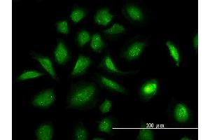 Immunofluorescence of monoclonal antibody to GART on HeLa cell. (GART 抗体  (AA 1-433))