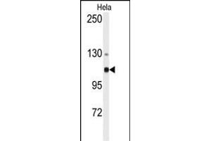 Western blot analysis of anti-ACTN4 Antibody (N-term) (ABIN392218 and ABIN2841914) in Hela cell line lysates (35 μg/lane). (alpha Actinin 4 抗体  (N-Term))