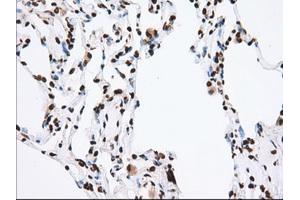 Image no. 3 for anti-Transforming, Acidic Coiled-Coil Containing Protein 3 (TACC3) antibody (ABIN1498096) (TACC3 抗体)