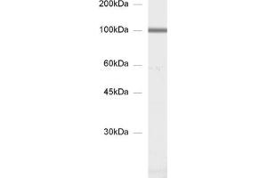 dilution: 1 : 1000, sample: synaptic membrane fraction of rat brain (LP1) (GluA 3 (AA 860-871) 抗体)