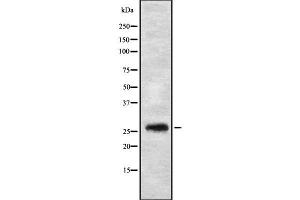 Western blot analysis FGFBP3 using HT29 whole cell lysates (FGFBP3 抗体  (C-Term))