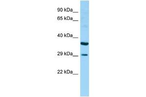 WB Suggested Anti-RAET1G Antibody Titration: 1.
