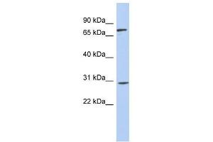 Western Blot showing ZNF131 antibody used at a concentration of 1-2 ug/ml to detect its target protein. (ZNF131 抗体  (Middle Region))