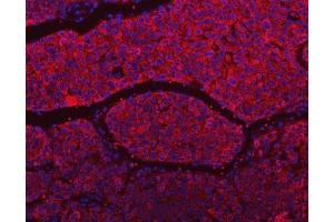 IF analysis of SLU7 using anti-SLU7 antibody (ABIN7601697).