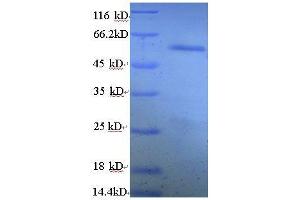 Fused in Sarcoma (FUS) (AA 1-198), (partial) protein (GST tag)