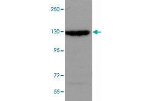 SRGAP2 polyclonal antibody  (0. (SRGAP2 抗体  (Internal Region))