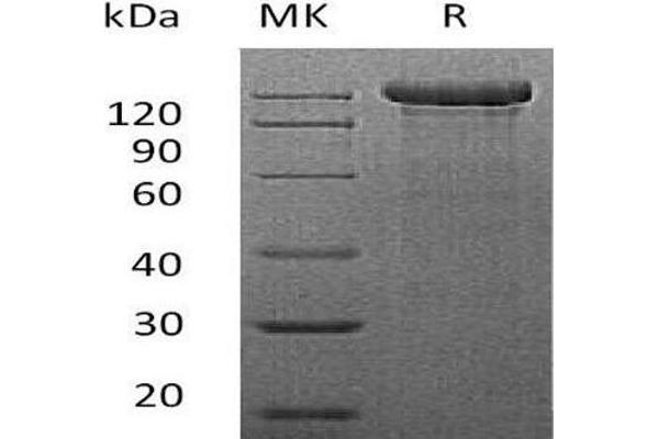 SEMA4C Protein (Fc Tag)