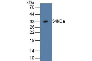 Detection of Recombinant WWP2, Human using Polyclonal Antibody to WW Domain Containing E3 Ubiquitin Protein Ligase 2 (WWP2) (WWP2 抗体  (AA 601-870))