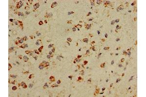 Immunohistochemistry (IHC) image for anti-Cytochrome C Oxidase Subunit Va (COX5A) (AA 42-150) antibody (ABIN7149167)
