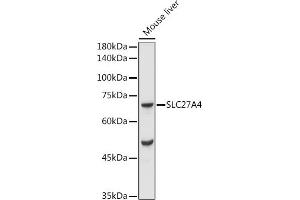 Western blot analysis of extracts of Mouse liver, using F/SLC27 antibody (ABIN7270444) at 1:1000 dilution. (SLC27A4 抗体  (AA 574-643))