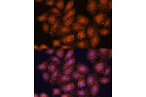 Immunofluorescence (IF) image for anti-SET and MYND Domain Containing 3 (SMYD3) (AA 50-150) antibody (ABIN7270260)