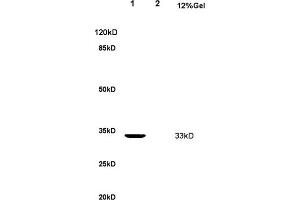 L1 rat kidney lysate L2 rat brain lysates probed with Anti Nucleophosmin Polyclonal Antibody, Unconjugated (ABIN1387533) at 1:200 overnight at 4 °C. (NPM1 抗体  (AA 21-120))