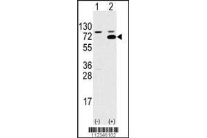 Western blot analysis of SWAP70 using rabbit polyclonal SWAP70 Antibody using 293 cell lysates (2 ug/lane) either nontransfected (Lane 1) or transiently transfected with the SWAP70 gene (Lane 2). (SWAP70 抗体  (AA 227-256))