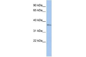 WB Suggested Anti-SIX3 Antibody Titration:  0. (SIX3 抗体  (N-Term))