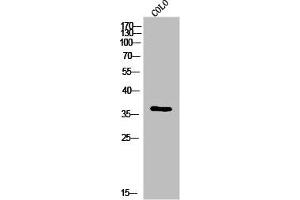 Western Blotting (WB) image for anti-Immunoglobulin Heavy Constant gamma 1 (G1m Marker) (IGHG1) (Internal Region) antibody (ABIN7187023)
