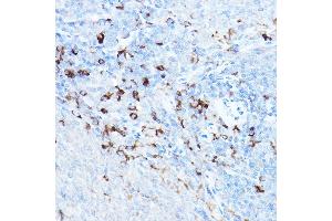 Immunohistochemistry of paraffin-embedded rat spleen using cI Rabbit pAb (ABIN1678920, ABIN3015349, ABIN3015350 and ABIN6213998) at dilution of 1:25 (40x lens). (BIRC3 抗体  (AA 1-180))