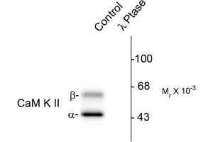 Image no. 1 for anti-Calcium/calmodulin-Dependent Protein Kinase II alpha (CAMK2A) (pThr286) antibody (ABIN372889) (CAMK2A 抗体  (pThr286))