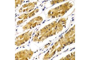 Immunohistochemistry (IHC) image for anti-Histo-blood group A transferase (ABO) (AA 54-354) antibody (ABIN3022191)