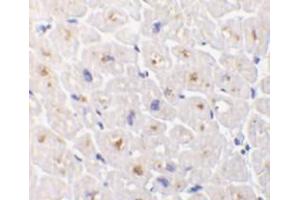 Immunohistochemistry (Paraffin-embedded Sections) (IHC (p)) image for anti-Tumor Necrosis Factor Receptor Superfamily, Member 6b, Decoy (TNFRSF6B) (N-Term) antibody (ABIN499726)