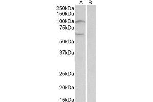 ABIN1781816 (2µg/ml) staining of Human Bone Marrow lysate (35µg protein in RIPA buffer) with (B) and without (A) blocking with the immunizing peptide. (UNC5B 抗体  (AA 629-643))