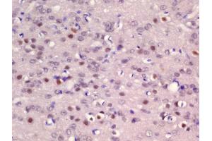 Formalin-fixed and paraffin embedded rat brain labeled with Rabbit Anti-ER81 Polyclonal Antibody, Unconjugated (ABIN1385970) at 1:200 followed by conjugation to the secondary antibody and DAB staining (ETV1 抗体  (AA 21-120))