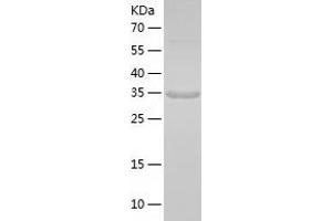 Western Blotting (WB) image for Melanoma Antigen Family A, 6 (MAGEA6) (AA 1-314) protein (His tag) (ABIN7286167) (MAGEA6 Protein (AA 1-314) (His tag))