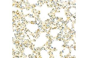 Immunohistochemistry (Paraffin-embedded Sections) (IHC (p)) image for anti-General Transcription Factor IIB (GTF2B) antibody (ABIN7074034)