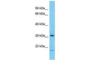 Western Blotting (WB) image for anti-Tryptase beta 2 (TPSB2) (Middle Region) antibody (ABIN2500609) (TPSB2 抗体  (Middle Region))