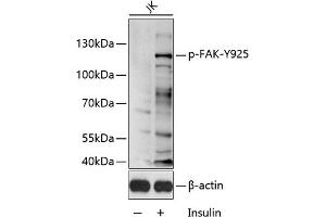 Western blot analysis of extracts of Jurkat cell line, using Phospho-FAK-Y925 antibody (ABIN6135297, ABIN6136216, ABIN6136217 and ABIN6225615) 1:1000 dilution. (FAK 抗体  (pTyr925))