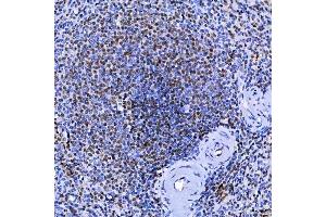 IHC analysis of SF3A1 using anti-SF3A1 antibody (ABIN7600556). (SF3A1 抗体  (AA 20-556))