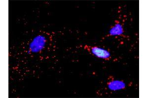 Proximity Ligation Analysis of protein-protein interactions between IGF1R and PIK3R3. (IGF1R 抗体  (AA 1-1367))