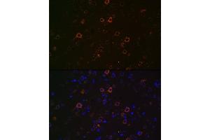 Immunofluorescence analysis of rat brain using Huntingtin Rabbit mAb (ABIN7267793) at dilution of 1:100 (40x lens). (Huntingtin 抗体)