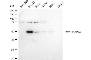 Western blotting analysis using TFAP2A antibody (ABIN7800591).