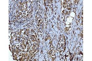 IHC analysis of Integrin linked ILK using anti-Integrin linked ILK antibody (ABIN7602632). (ILK 抗体  (AA 9-452))