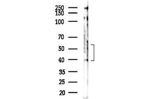 Western blot analysis of lysates from B16F10-LUC cells(UV,30 min treatment), using Phospho-TGFBR1 (Thr186) Antibody at 1/1000 dilution.