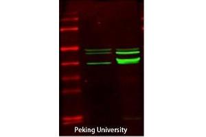 Western Blot (WB) analysis: Please contact us for more details. (CKM 抗体  (N-Term))