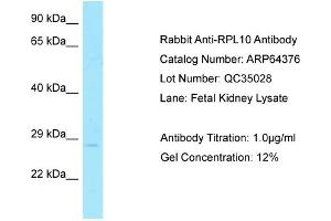 Western Blotting (WB) image for anti-Ribosomal Protein L10 (RPL10) (C-Term) antibody (ABIN2789821) (RPL10 抗体  (C-Term))