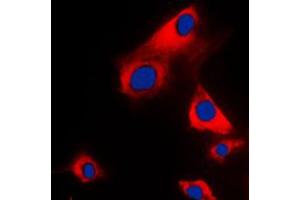 Immunofluorescent analysis of Glycerol Kinase 1 staining in H9C2 cells. (Glycerol Kinase 1 抗体  (C-Term))