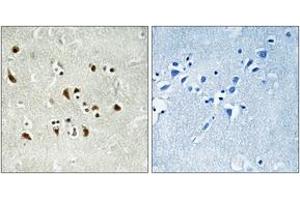 Immunohistochemistry (IHC) image for anti-Tubulin, gamma Complex Associated Protein 6 (TUBGCP6) (AA 741-790) antibody (ABIN2890337) (GCP6 抗体  (AA 741-790))
