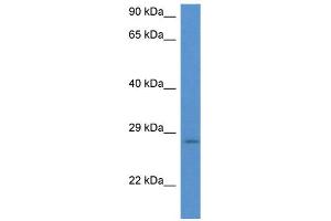 WB Suggested Anti-EIF6 AntibodyTitration: 1. (EIF6 抗体  (N-Term))
