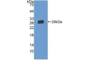 Detection of Recombinant TIGIT, Human using Polyclonal Antibody to T-Cell Immunoreceptor With Ig And ITIM Domains Protein (TIGIT) (TIGIT 抗体  (AA 21-234))