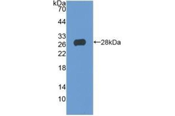 TIGIT 抗体  (AA 21-234)